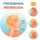 trigeminal neuralgia nerves